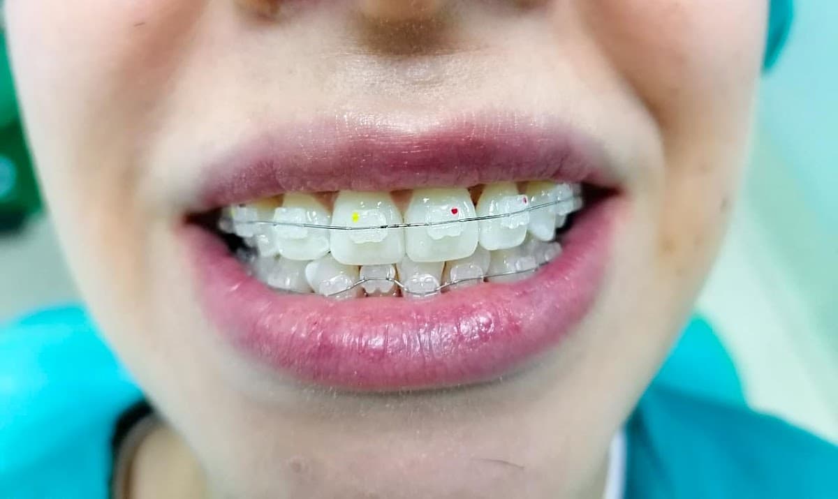 Premium Dental Medellín — foto