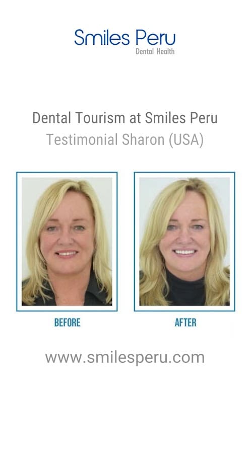 Smiles Peru — foto