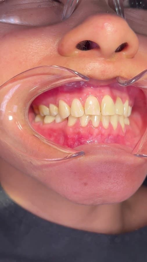 Odontologo Dr Cristhian Figueroa - Odontologia en Bucaramanga - Diseño de sonrisa — foto