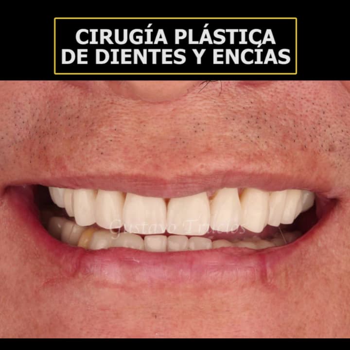 EVOLUTION-Clínica Dental Trucios — foto