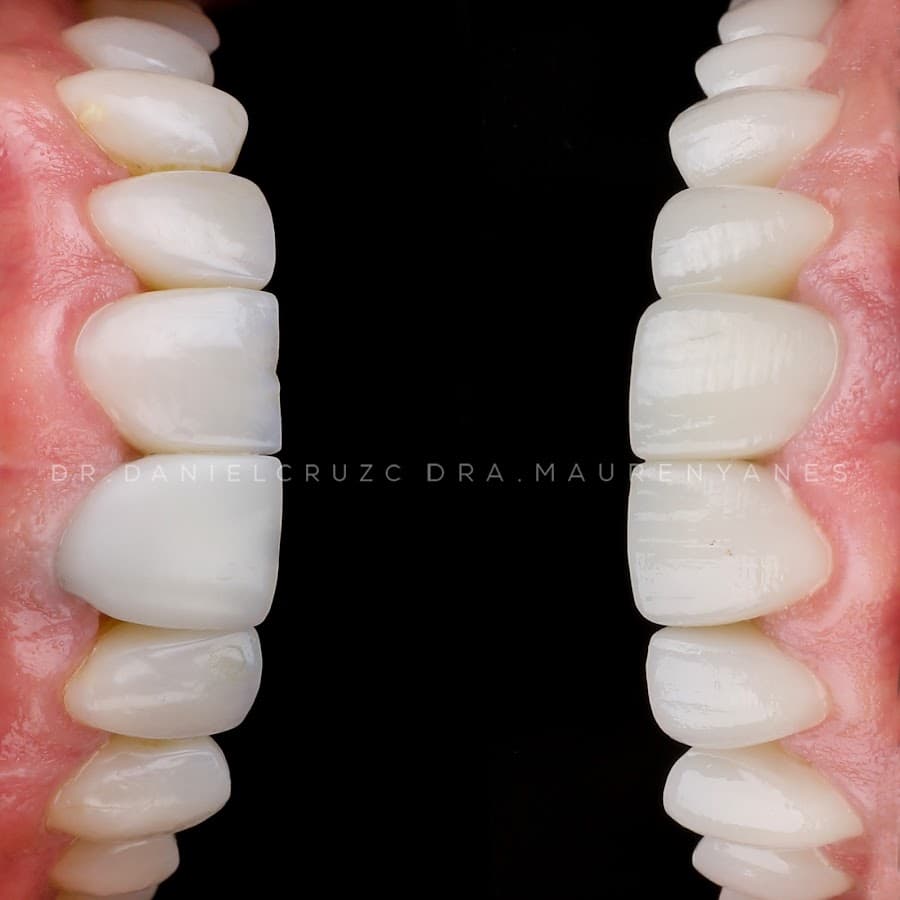 DENTAL SMILE CONCEPT — foto