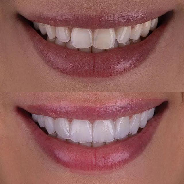 Odontología Ibagué New denti