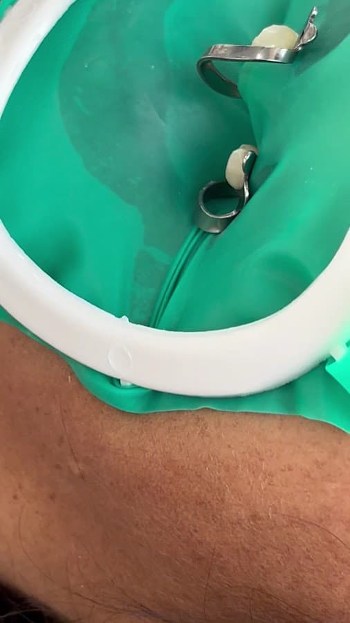 CLÍNICA DENTAL PARADISE - PUENTE NUEVO — foto