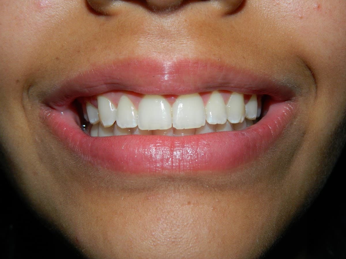 Dental Home
