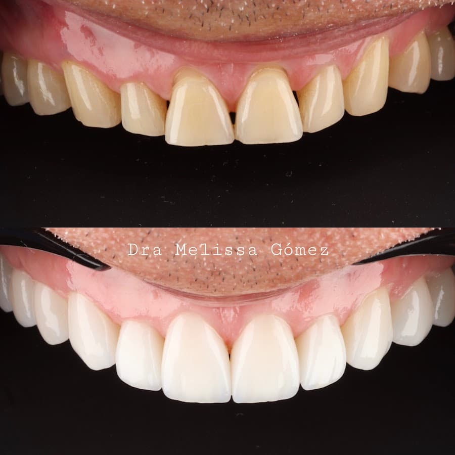 Dra Melissa Gómez- Creadent Especialistas en sonrisas.
