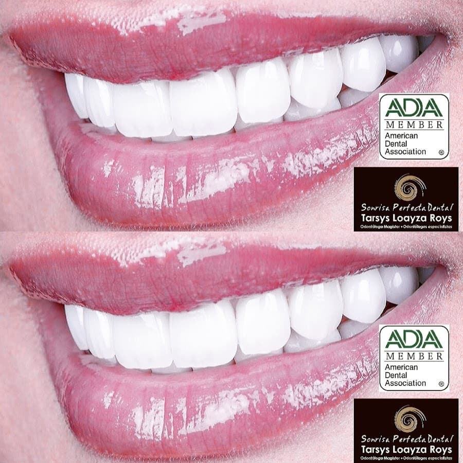 Sonrisa Perfecta Dental - Tarsys Loayza Roys — foto