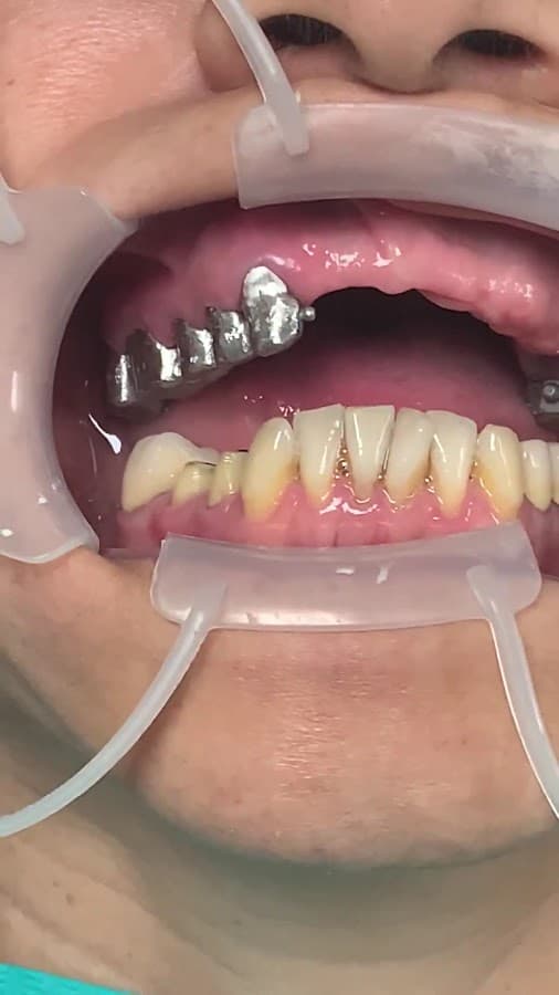 Dentista en Miraflores - Lima -Odontodigital — foto
