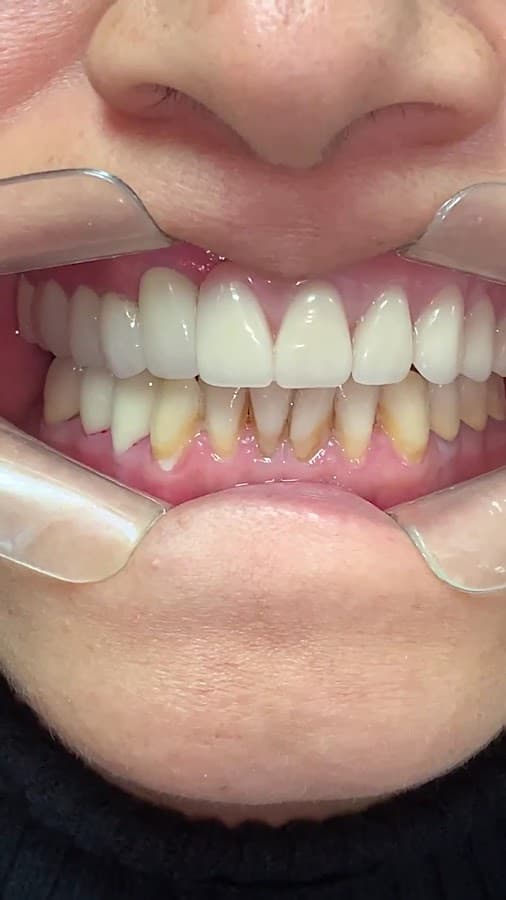 Dentista en Miraflores - Lima -Odontodigital — foto