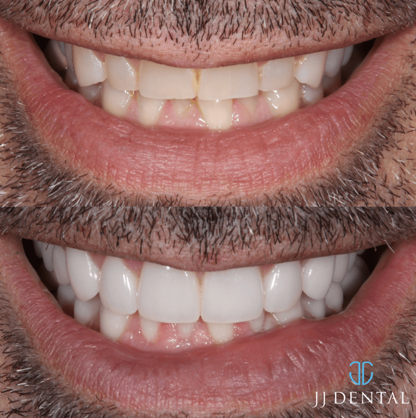 JJ Dental