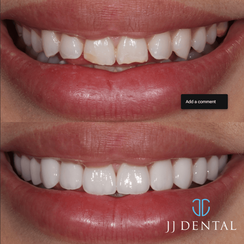 JJ Dental — foto