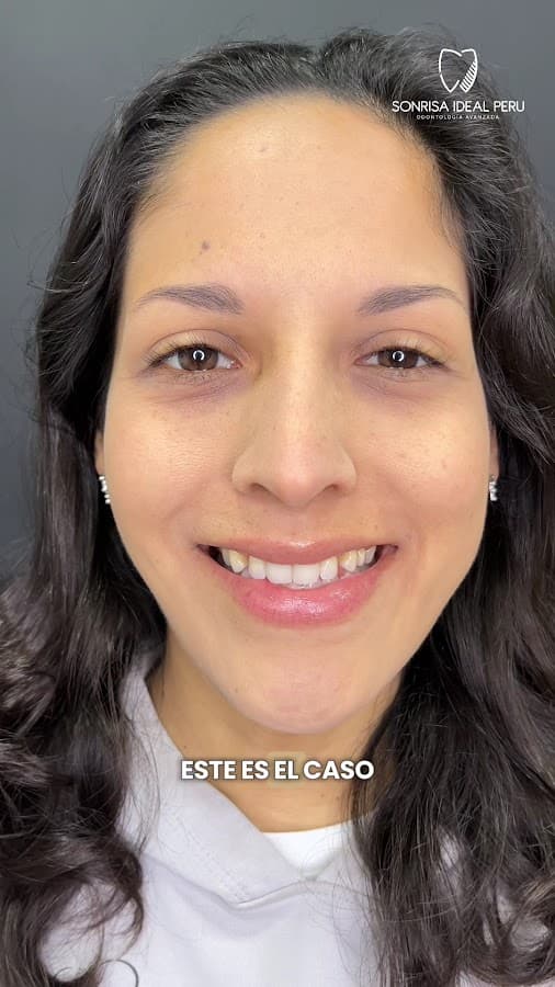 Sonrisa Ideal Perú - Dentista San Miguel — foto