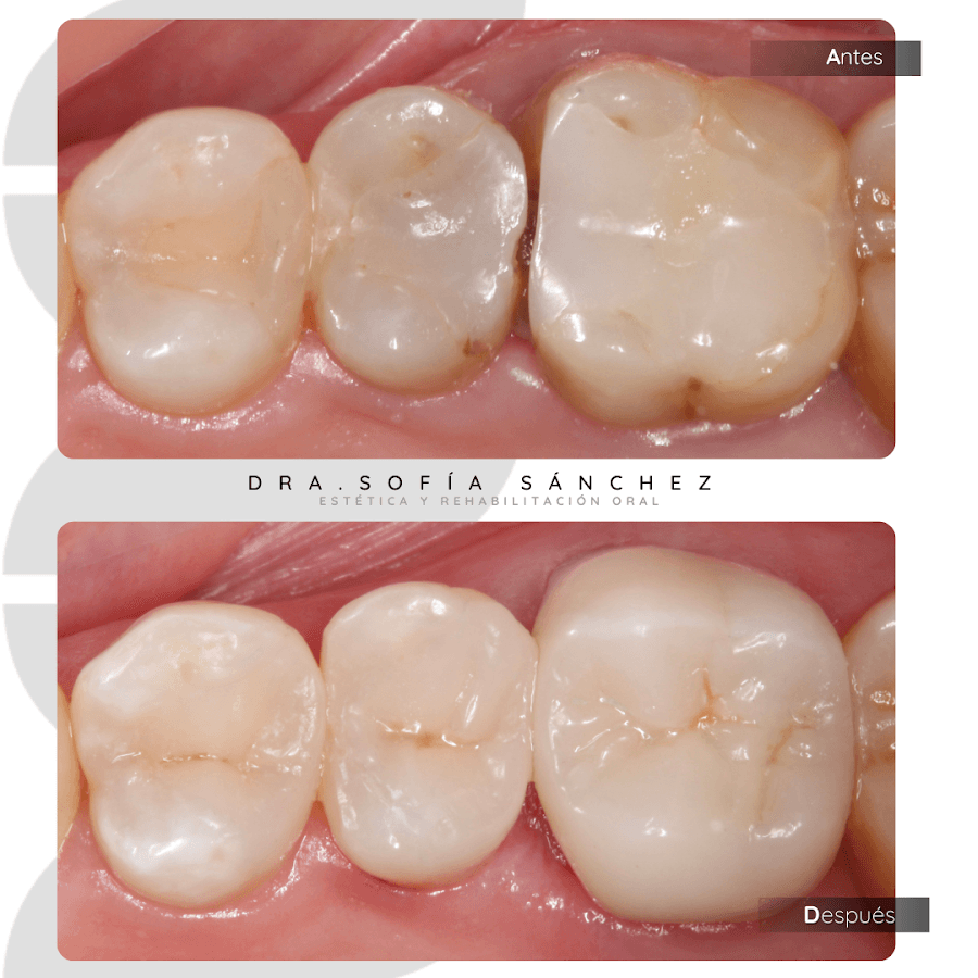 Dra. Sofía Sánchez - Estética y Rehabilitación Oral — foto