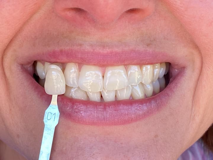 Clinica Dental IMPLANTA — foto