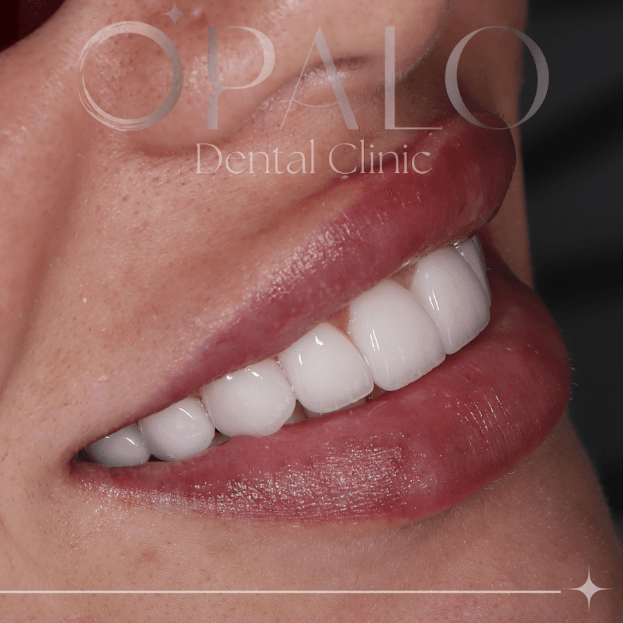 OPALO DENTAL CLINIC — foto