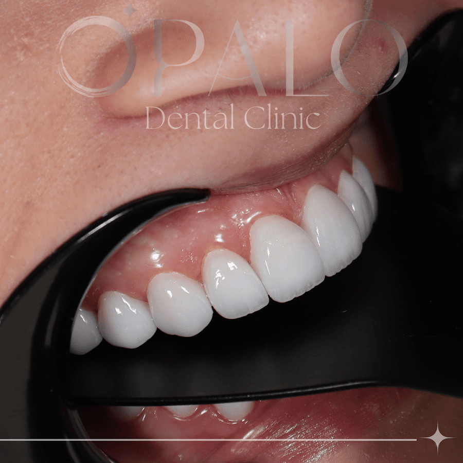 OPALO DENTAL CLINIC — foto