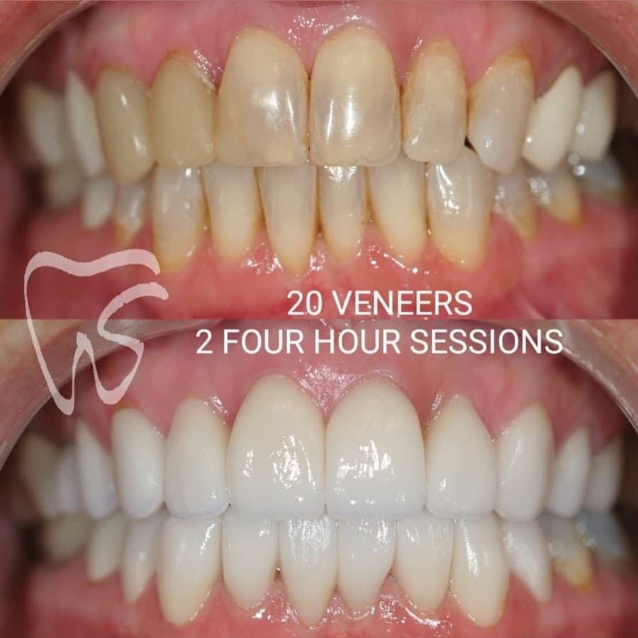 Stanton Smiles — foto