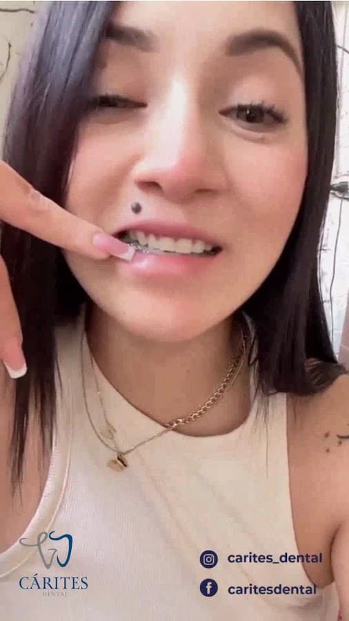 Cárites Dental — foto