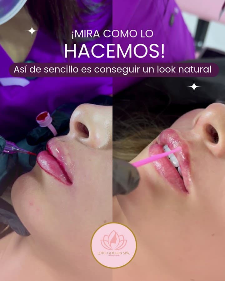 LOTO GOLDEN SPA IBAGUÉ — foto