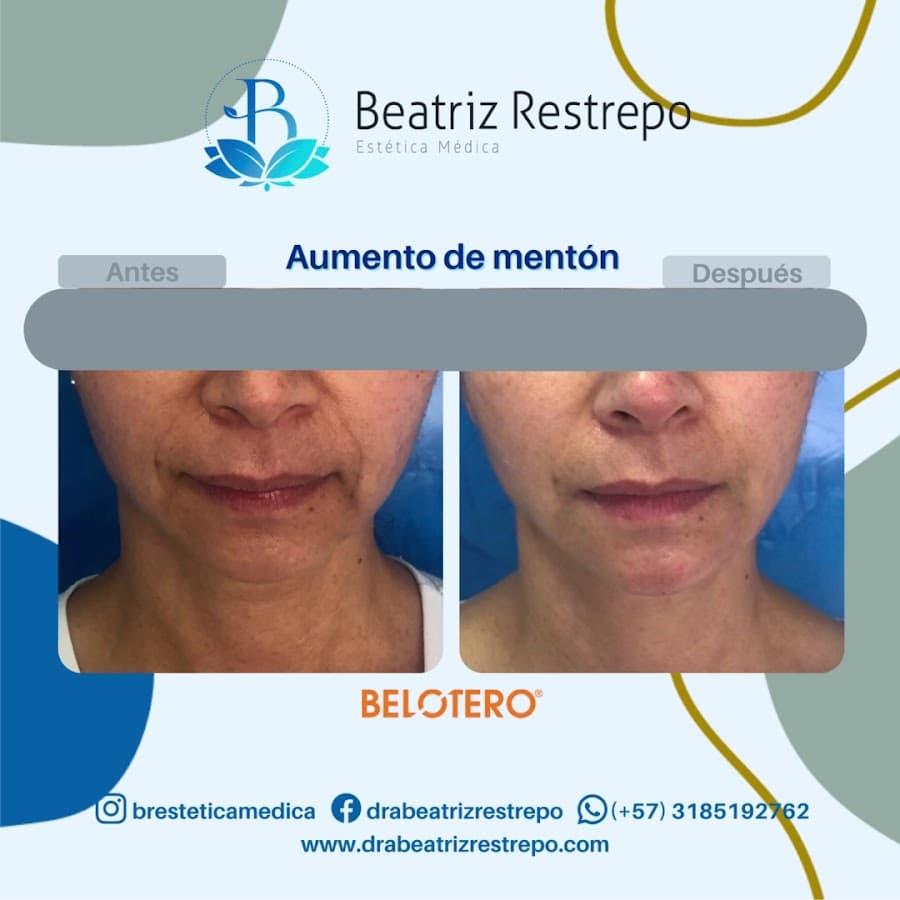 Beatriz Restrepo Estetica Médica — foto