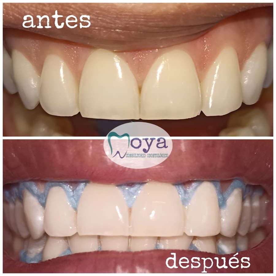 Consultorio Odontológico MOYA