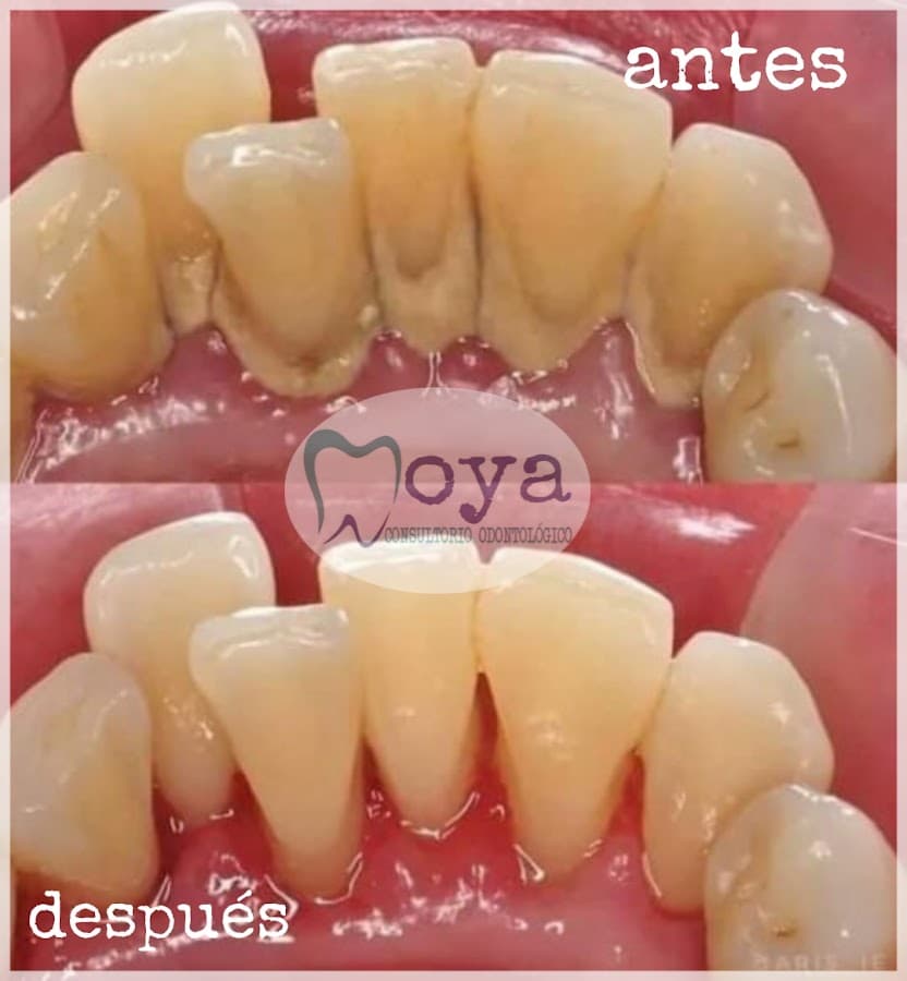 Consultorio Odontológico MOYA — foto