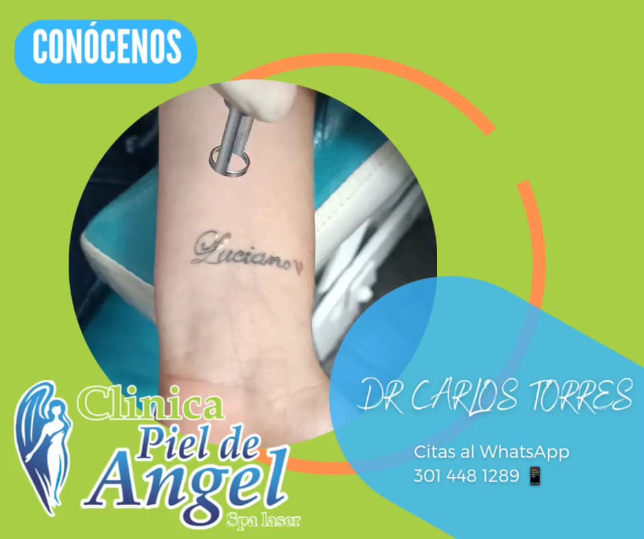 Clínica Piel De Ángel spa láser — foto