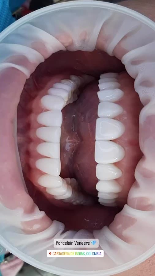 Dr Federico Pinaud - Odontología Estética — foto