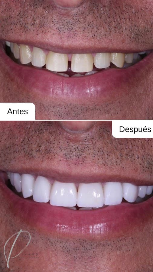 Dr Federico Pinaud - Odontología Estética — foto