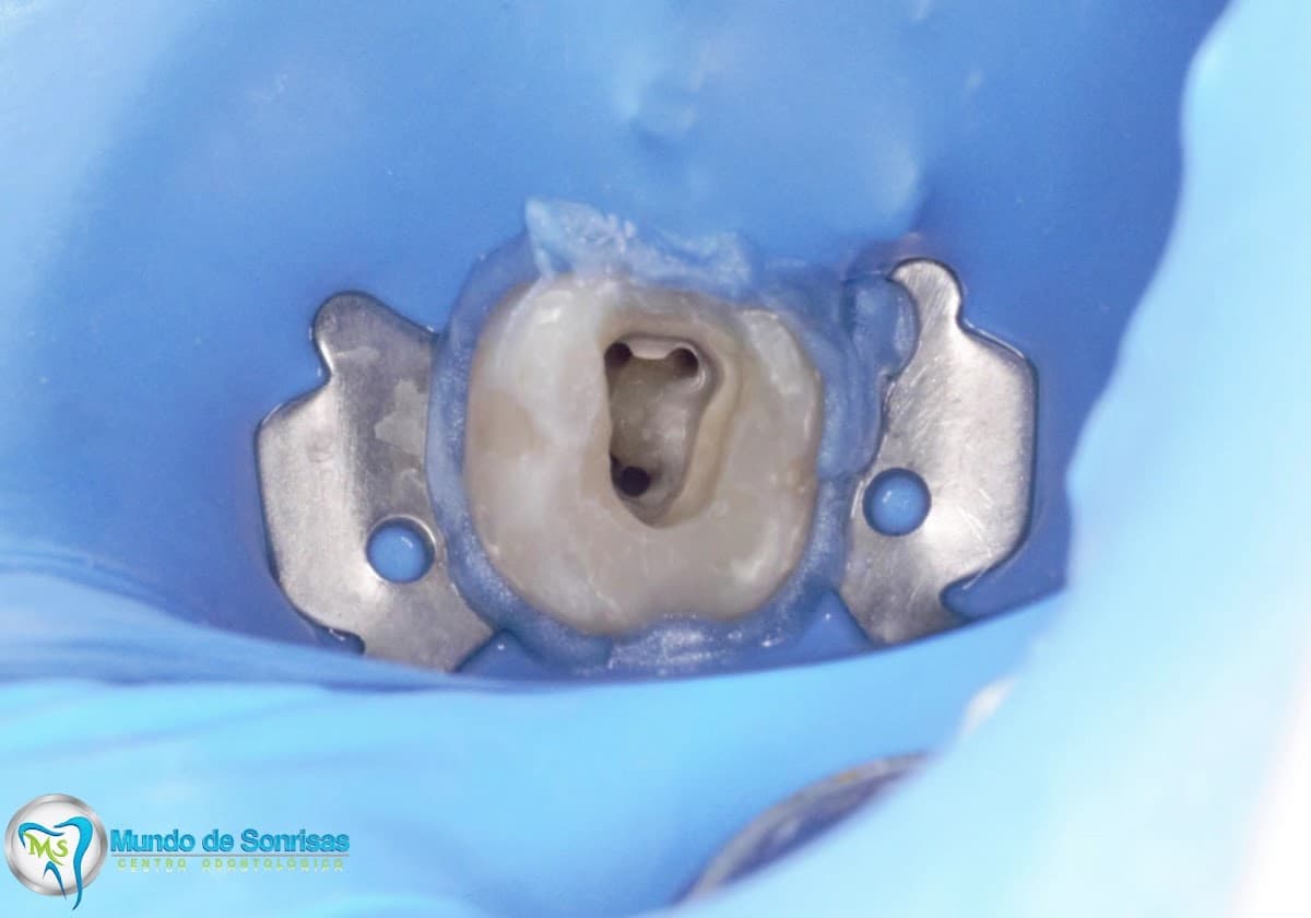 Dr. Manuel Calle Berrú - ODONTOLOGO — foto