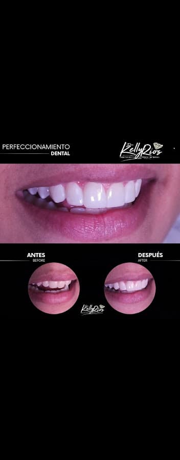 Centro de Odontología estética Dra. Kelly Ríos