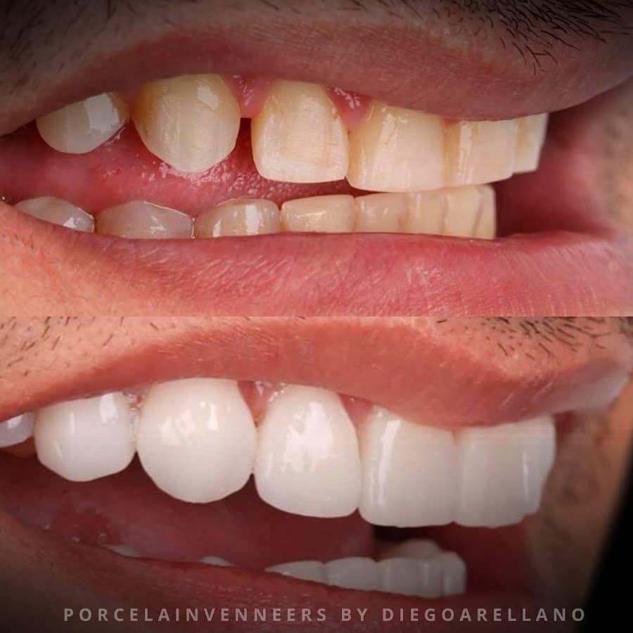 Dentury by Dr. Diego Arellano