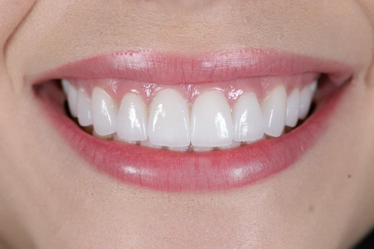 Odontosalud-P — foto