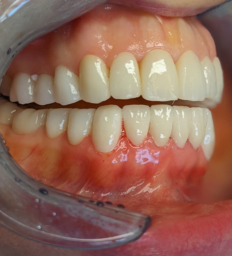NewStar Dental – Dentist in Fort Lauderdale