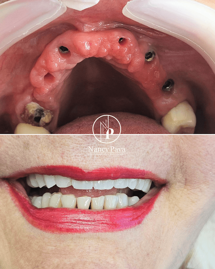 Odontología, Dra Nancy Pava, Especialista implantología oral y reconstructiva — foto