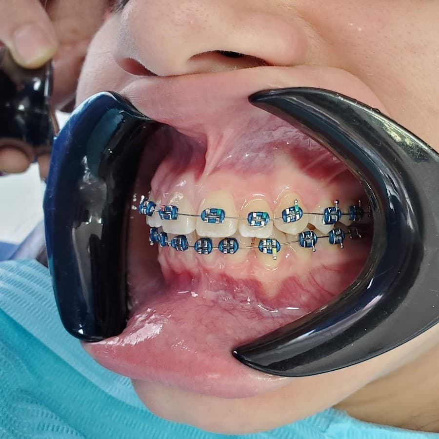 Clinica Dental Indacochea (Matriz) Diseño de Sonrisas — foto