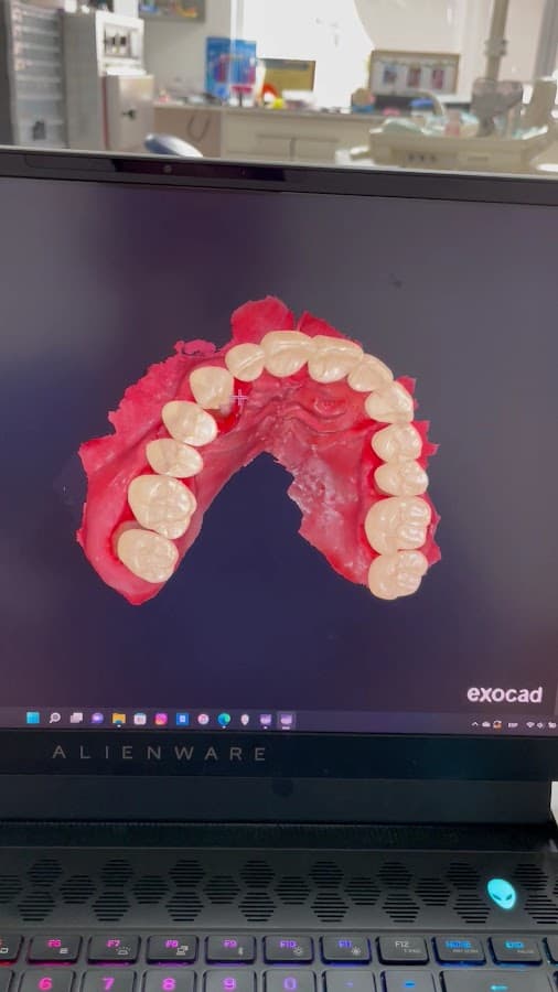 Clinica Dental Indacochea (Matriz) Diseño de Sonrisas — foto