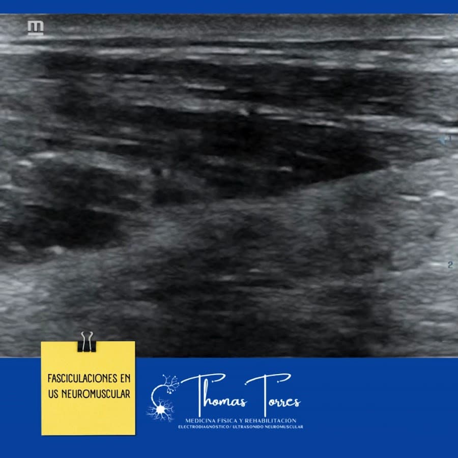 Dr. Thomas Torres · Fisiatra · Dolor & Rehabilitación Avanzada · Proloterapia · Magnetoterapia · EMSELLA · Ibagué — foto