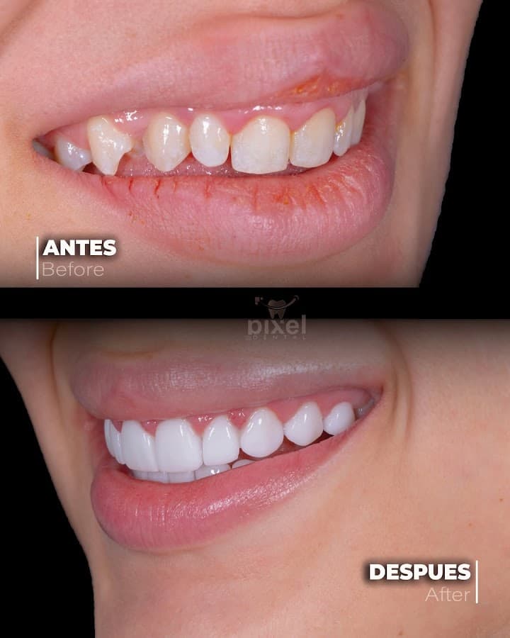 Odontología Pixel Dental Pereira — foto