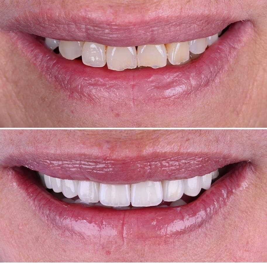 Clinica odontologica Glahden — foto