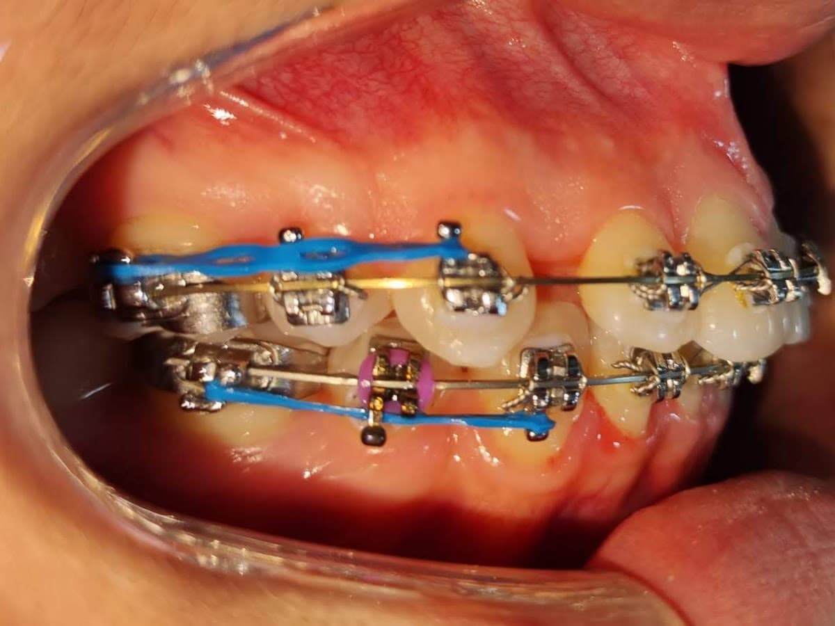 Clínica Dental Sonrisa Bonita - Ortodoncia e Implantes Dentales — foto