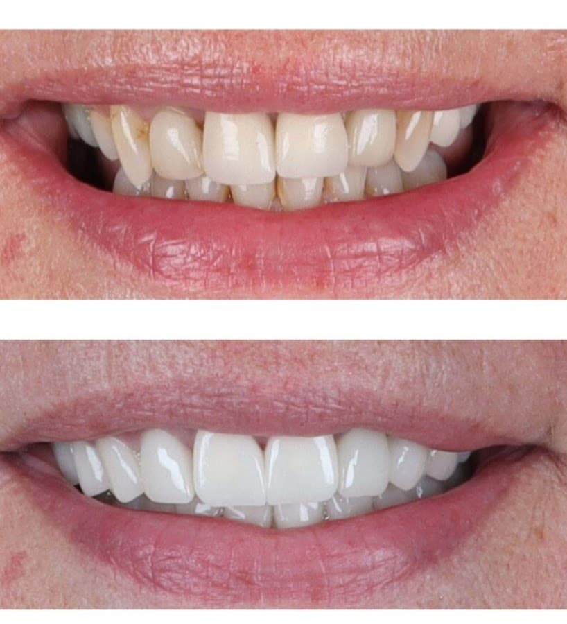 Blue Hearts Dental — foto