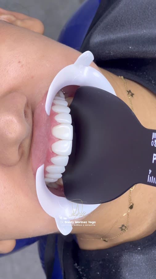 Odontología estética y correctiva — foto