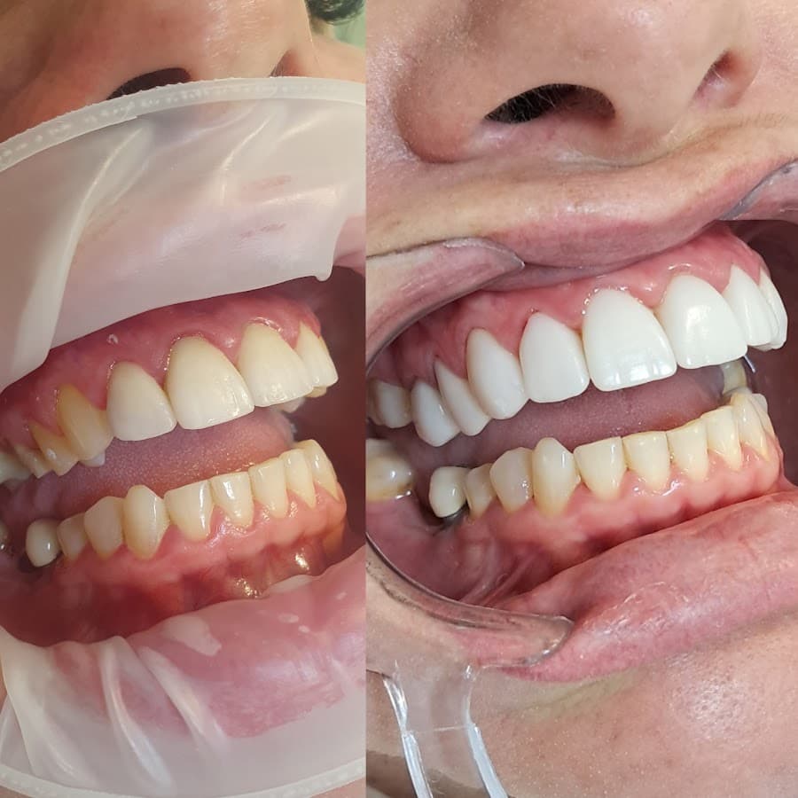 Dra. Rossana Fucks | Dentista em Itapema | Reabilitação Oral & Facial integrados | Método ROF