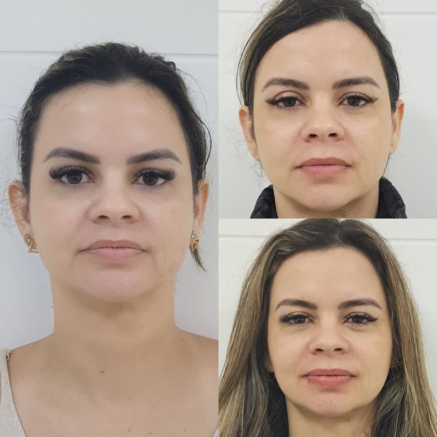 Dra. Rossana Fucks | Dentista em Itapema | Reabilitação Oral & Facial integrados | Método ROF — foto