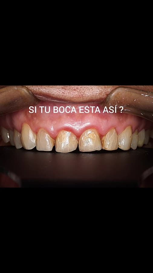 Clínica Sonrilaser - Ortodoncia - Implantes Dentales en Cúcuta - Colombia. — foto