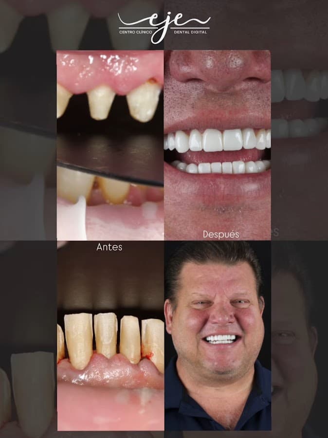 EJE Centro Clinico Dental - Digital Dentistry