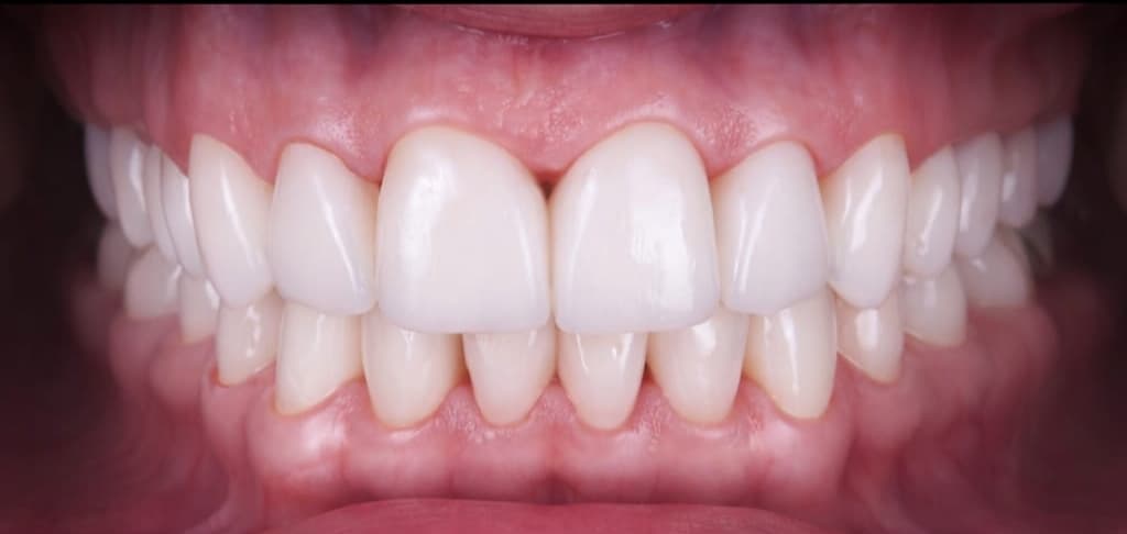 Odontologia Cali - Dra Juliana Alvarez Robayo — foto
